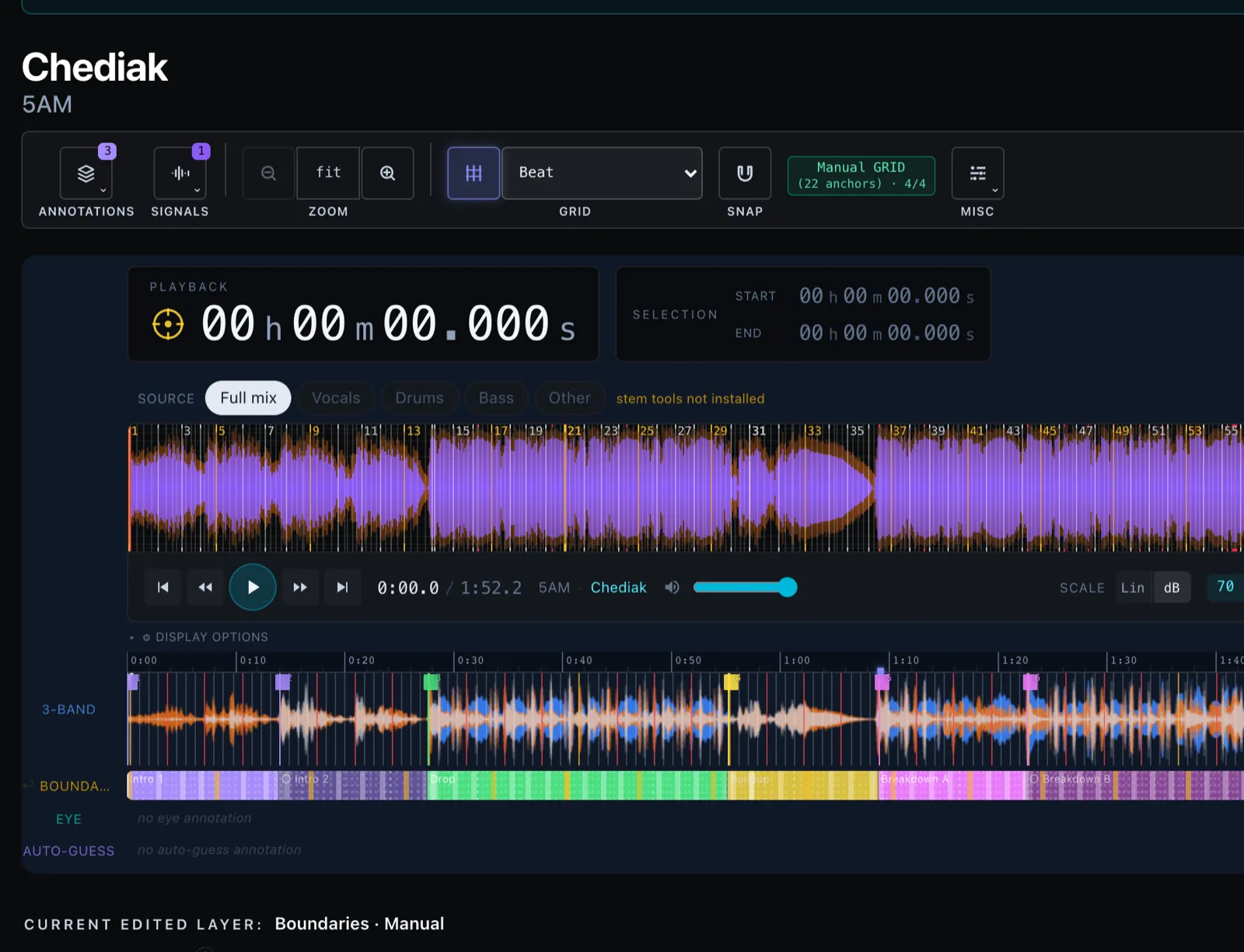 The Annotator Tool — title, control bar, player, stacked signal rows, and the structure-sections editor
