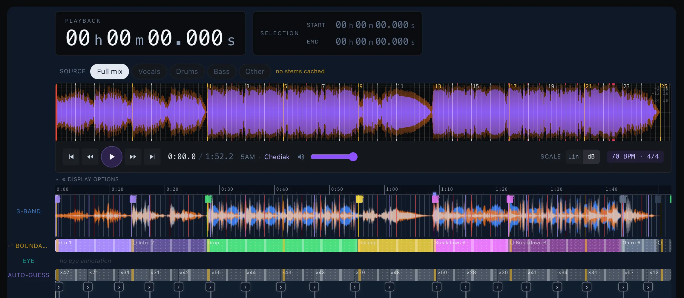 Algorithm Inspect — per-song view with stacked algorithm prediction rows over the waveform